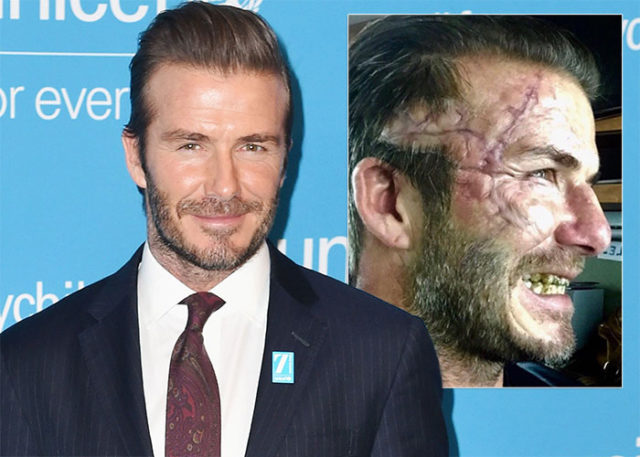 David Beckham aparece todo machucado (de mentira) no Instagram